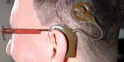 Cochlea Implantat