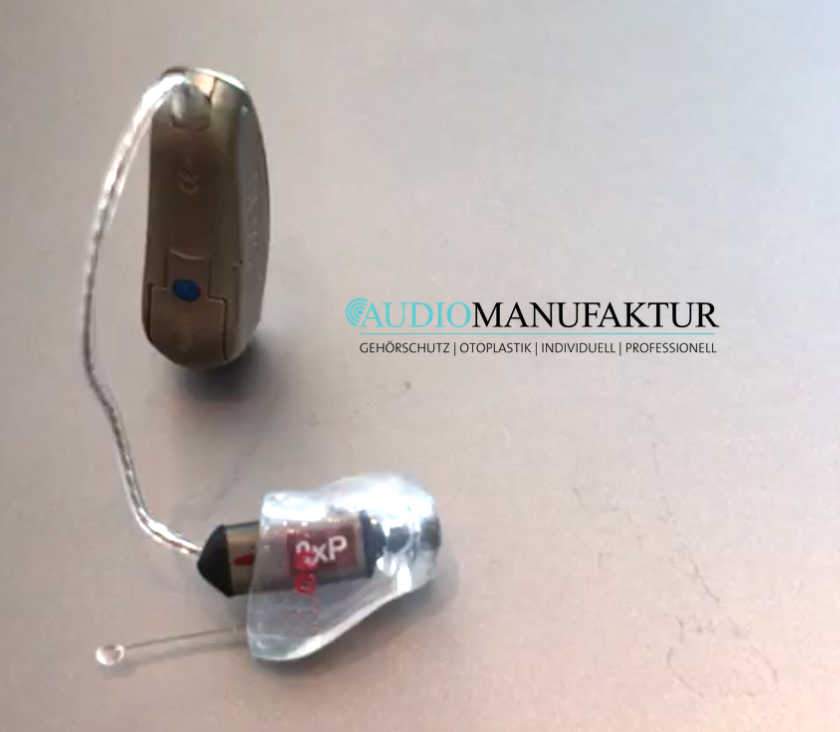 Gibt es auch gute Otoplastiken?